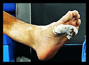 chung_foot_ao18